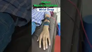 Perfect Muscle Stimulation in Wrist Drop || #Shorts #shortvideo #physiodrdeepaksoni