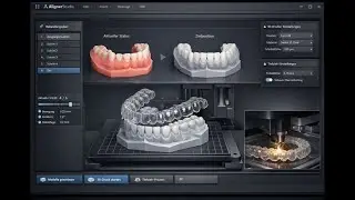 Alignersoftware, CAD/CAM und CNC Software f&uuml;r CNC Maschinen, 3D Drucker und Roboteranlagen. ENCY