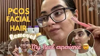 PCOS Facial Hair Removal || my real experience 😱😳 || tips&management !! 