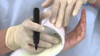 Moderne Schienenversorgung Daumen- und Handgelenk-Immobilisator_DE_von BSN medical.mov