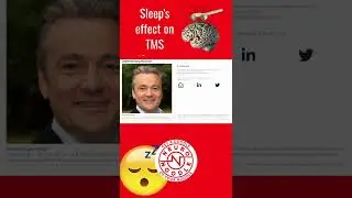 The Effect Sleep Has on TMS Therapy