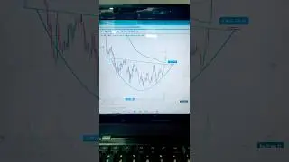 🕉️ Check  results my analysis never flailed | metropolis health share on fire 🔥  #swingtrade