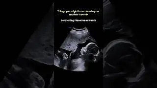 Baby routine during pregnancy #pregnancy #science #emotional #shorts #ytshorts 