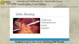 Getting Lost in the Liver (Getting Off Plane)