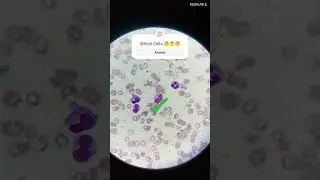 white blood cells identification,#microscope #underamicroscope