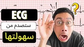 شرح ECG | الجزء 4 |  ECG Leads | Bipolar, Limb &  Chest Leads