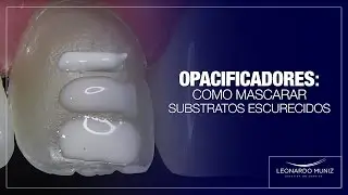 Opacificadores: Como mascarar substratos escurecidos | Leonardo Muniz