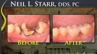 Washington, DC Dentist -- Dr. Neil Starr   20036