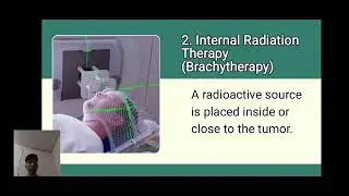 Radiation Theraphy - Modern Physics ( Submitted to: LJ Concha