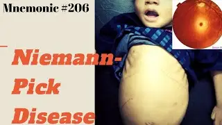 Niemann-Pick disease mnemonic for USMLE Step 1
