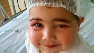 Crian&ccedil;a de 2 anos perde vis&atilde;o de um olho ap&oacute;s contrair doen&ccedil;a grave | DTUP
