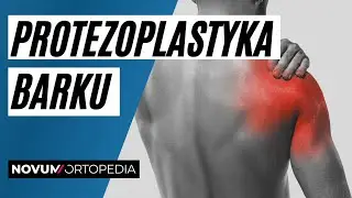 Protezoplastyka stawu barkowego | Novum Ortopedia