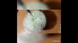 Eno with lemon water reaction. full explanation. .