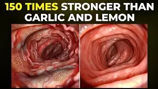 Relieve Back Inflammation 150 times stronger than lemon! Destruction of Bacteria fights inflammation