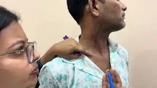 jugular veins surface markings
