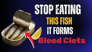 Seniors Over 60: Stop Eating THESE Fish&mdash;They Can Trigger a Stroke Overnight! | Senior Health Secrets