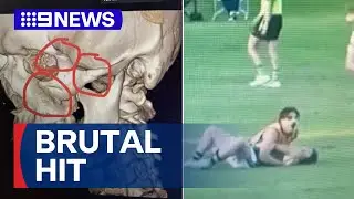 Local footballer left with fractured skull after on-field clash | 9 News Australia