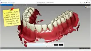 Trophy Imaging Software University | Herramienta de Chequeo de Historial de Escaneo Trophy 3DI PRO