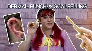Stretching Methods to Be Cautious About: Scalpelling and Dermal Punch
