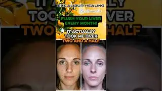 Lose Weight With Liver Flushing! #livercleanse #weightloss