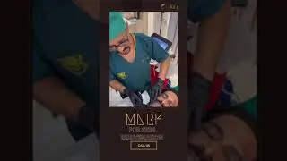 MNRF for Skin Rejuvenation | Dr. V. S. Rathore | #shorts #youtubeshorts #shortsvideo