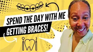 Getting Braces over 50! Spend the Day with Me | Turbo Fast-Braces Journey for a Confident Smile