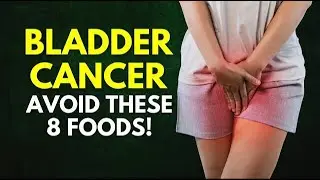 *&ldquo;These 8 Foods Can Increase Your Risk of Bladder Cancer Without You Knowing&rdquo;**
