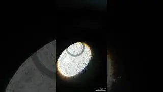 What a active red blood cells looks like under a microscope 225x, 450x, 675x