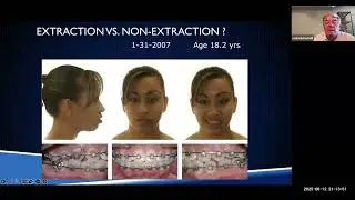 Recent Advances & Emerging Technologies in Orthodontics