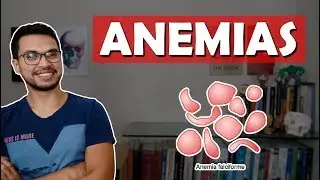 ANEMIA FALCIFORME [Hemato 02]