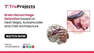 Brain Hemorrhage Detection based on Heat Maps, Autoencoder and CNN Architecture