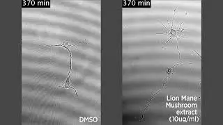 Neuronal growth when treated with the lion&rsquo;s mane mushroom extract (right)