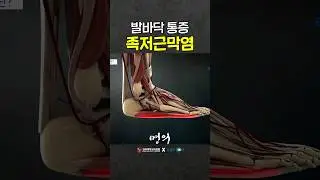 손흥민도 겪었던 족저근막염