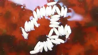 Drain flies eggs  - Psychodidae - or - Blow flies eggs - Calliphoridae ? - Fluguegg