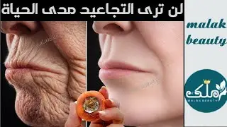 التجاعيد اختفت والنتائج لا تصدق🔥دهنه منه ولن ترى تجاعيد مدى الحياة