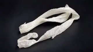 Why Snakes Shed Their Skin | Pet Snakes