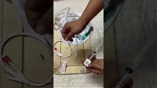 Compass for intra abdominal pressure monitoring