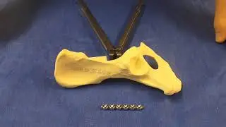 Contouring a 2.7mm SOP locking plate