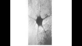 CDIS 4037 Auditory Nerve Part 1 (KT Done)