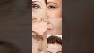 The power of retinal ✅✨ #celimax #retinal #wrinkle #antiage #koreanskincare