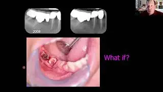 Diagnostic Considerations and Treatment Options for Difficult Cases with Dr. Edward Feinberg