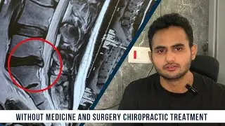 L5,S1 Disc Bulge Without surgery And medicine Chiropractic treatment #chiropractormoradabad 