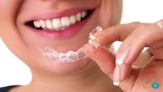 Invisalign | Invisalign Aligners | Renken Dentistry
