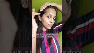 Mamaearth Rosemary Oil 😲 for Hair growth 💹#shorts #youtubeshorts #trending