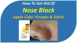 how to get rid of nose block - Apple Cider Vinegar & Garlic