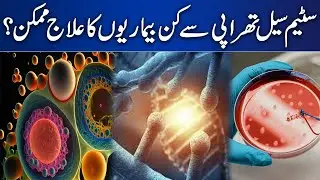 Stem Cell Therapy Kay Zariye Kin Beemariyo Ka Elaaj Mumkin Hai ? | Jaago Lahore