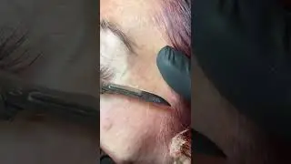 Dermaplaning with Mask @medandspaburrridge  #dermaplaning #facial #skincareroutine