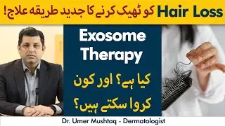 What Is Exosome Therapy? Exosomes Kya Hai? | Advanced Hair Loss Treatment