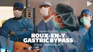 Laparoscopic Distal Pancreatectomy with Splenectomy (360) by Travis J. McKenzie, MD | Case Trailer