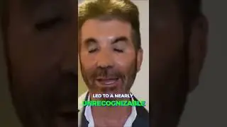Трагическая пластическая операция Саймона Коуэлла